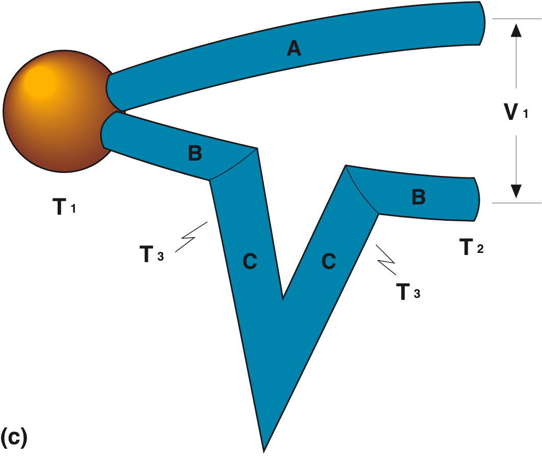 temperature