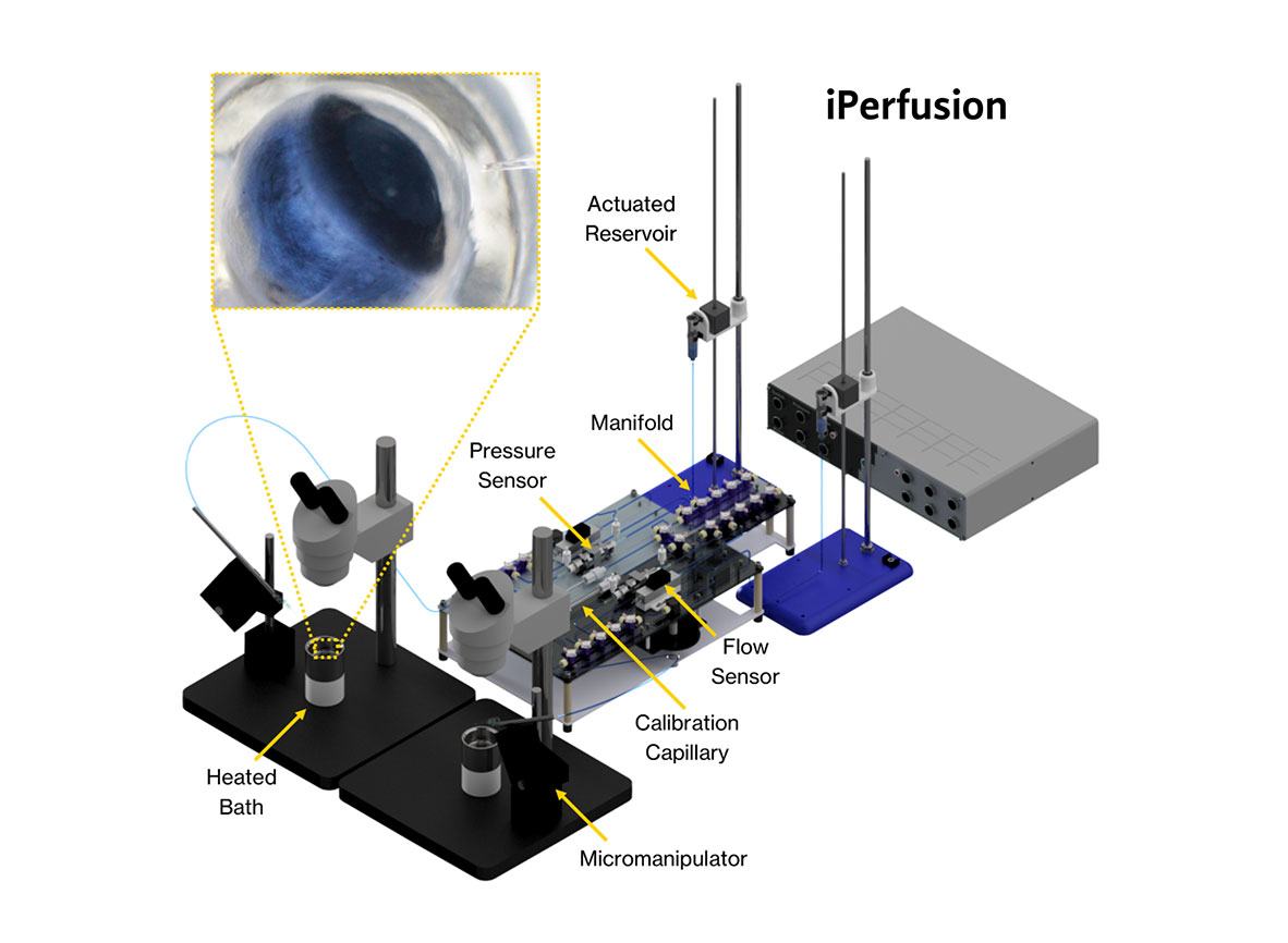 iPerfusion